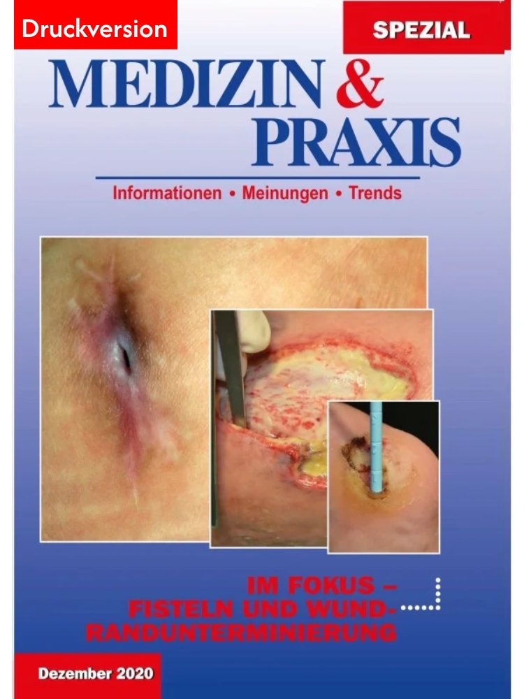 Fisteln und Wundrandunterminierung - 2020