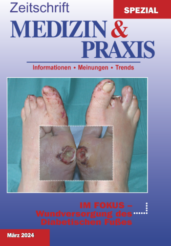 Wundversorgung des Diabetischen Fußes - 2024