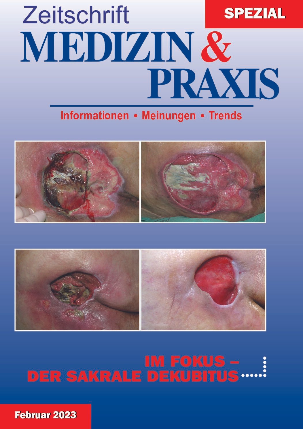 Der sakrale Dekubitus - 2023