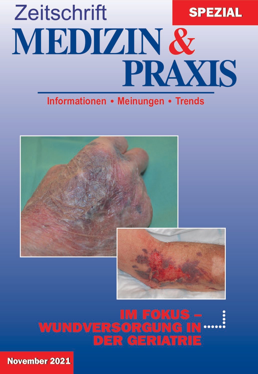 Wundversorgung in der Geriatrie   -   2021